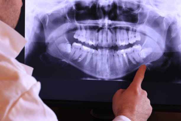 Professional Emergency Dental Service in NC